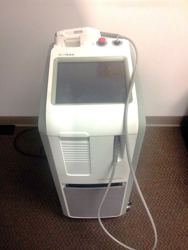 2013 Cutera Genesis Plus 1064 nm Nd Yag Rock Bottom Lasers