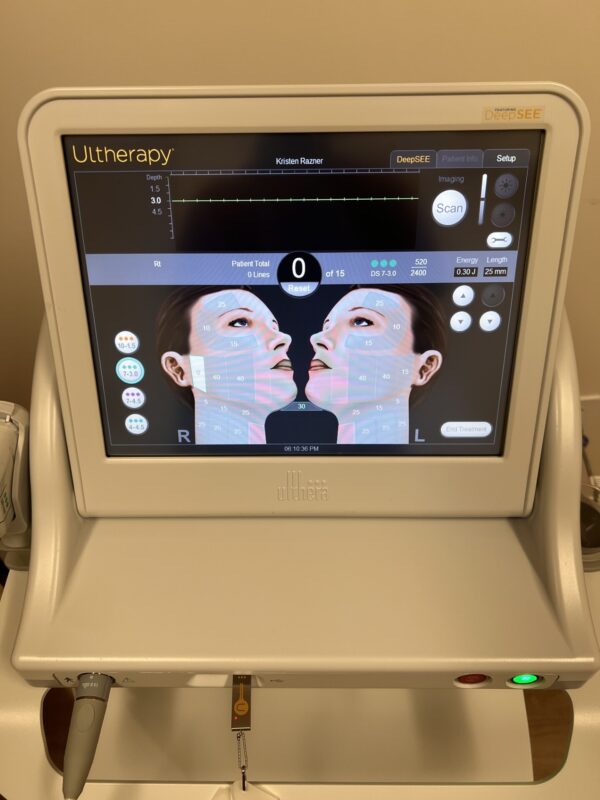 2021 Merz Ulthera Ultherapy Ultrasound Skin Tightening System - UH-2 DeepSee Handpiece - Includes Transducers - Free Shipping & Warranty (km/con-ve) - Image 9