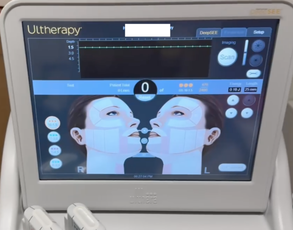 2024 Merz Ulthera Ultherapy Ultrasound Skin Tightening System - with 2024 UH-2 DeepSee Handpiece - PERFECT CONDITION - ONLY USED 10x - Free Shipping & Warranty (km/tan) - Image 10