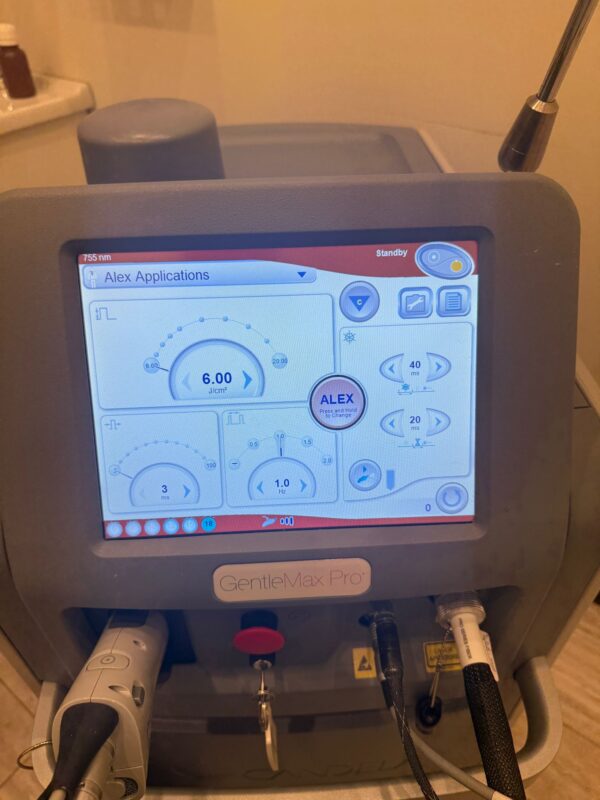 2019 Candela Gentlemax Pro 755nm & 1064nm Dual Wavelength - Hair Removal, Pigment, Vascular Lesions, Skin Rejuvenation - Received Full Maintenance Service- Free Shipping & Warranty (km/qui) - Image 6
