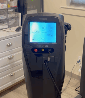 2022 Alma TED TransEpidermal Delivery - Non-Invasive Hair Restoration - Scalp Treatment - INCLUDES SUPPORT FOR CONSUMABLE PURCHASING - Free Shipping & Warranty (km/rin)