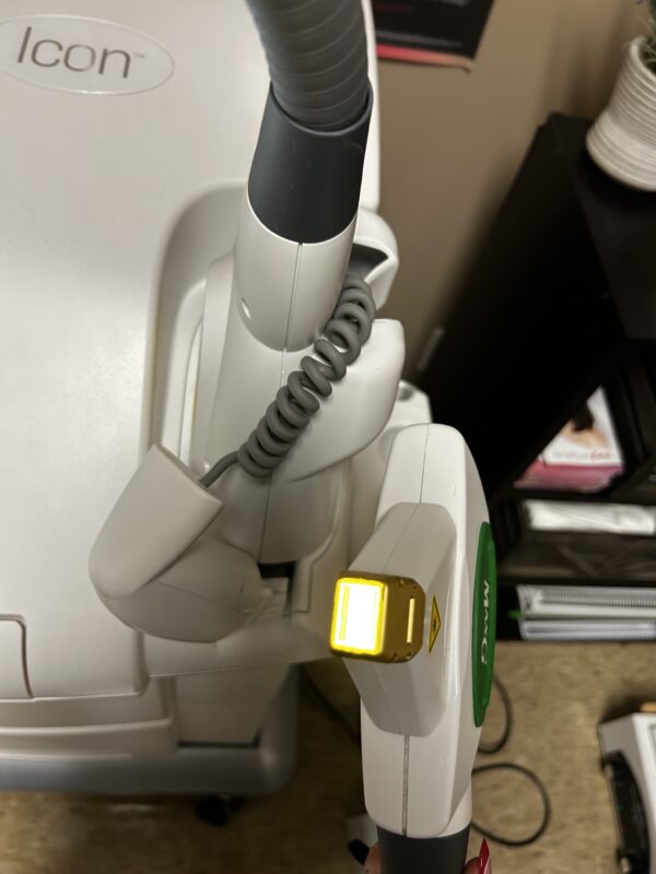 2021 Cynosure Palomar Icon w/ MaxG IPL for Pigment & Vascular Lesions - Free Shipping & Warranty (km/ran) - Image 8