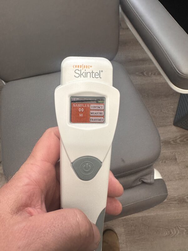 2022 Cynosure Elite IQ - 755nm & 1064nm - 2.5mm to 24mm Spot Sizes - LOW USE & PULSES - for Hair Removal, Pigment & Vascular, Warts, Wrinkles, Rosacea and More - Free Shipping & Warranty (km/swi) - Image 34