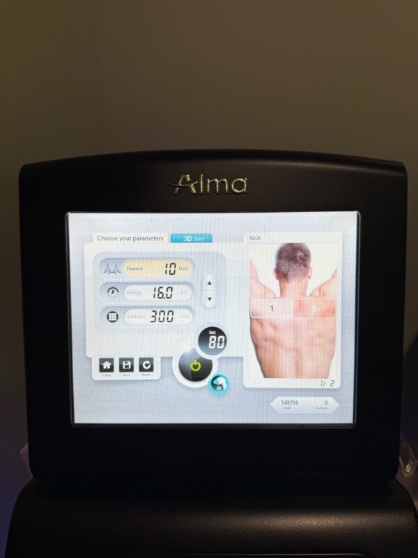 2022 Alma Soprano Ice PLATINUM - WITH 2 HANDPIECES - Trio 3D 2cm x 2cm Spot Size Handpiece, & Ice Speed Diode Handpiece - Diode 810, Alex 755nm & Nd Yag 1064nm Hair Removal Laser - Low Pulses - Free Shipping & Warranty (jp/mof-rt) - Image 7
