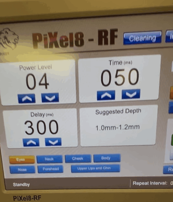 2022 Rohrer Aesthetics Pixel8-RF PRO - UPGRADED PRO VERSION w/ 4 MHz - with Microneedling RF Skin Tightening & Skin Smoothing - INCLUDES 10 NEW PIXEL8 TIPS and ONGOING CONSUMABLE SUPPORT - Cart Not Included - Free Shipping & Warranty (jp/jg30-02) - Image 6