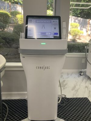 2019 Cynosure Potenza Microneedling w/ Monopolar/Bipolar Radio Frequency with Acne Handpiece - Free Shipping & Warranty - CONSUMABLE SUPPORT INCLUDED (jp/oco)