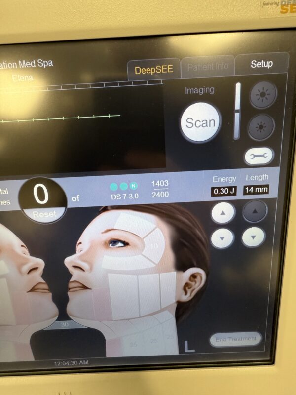 2015 Merz Ulthera Ultherapy Ultrasound Skin Tightening System with UH-2 DeepSee Handpiece - Free Shipping & Warranty (km/bai-pa) - Image 15