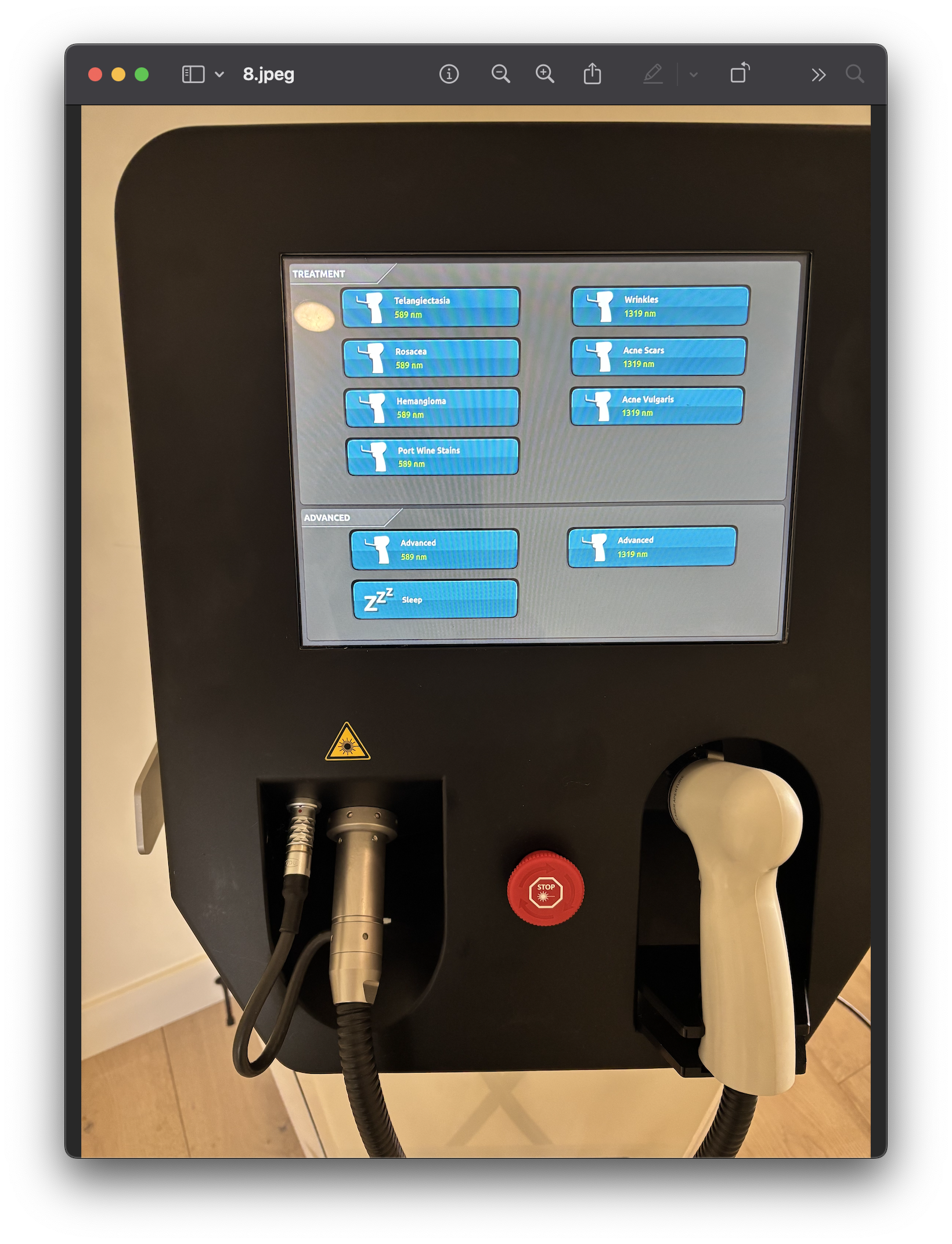 2021 Advalight ADVATx Dual-Wavelength Laser - 589 nm Yellow Light & 1319 nm Infrared Light for Acne, Non-Ablative Skin Rejuvenation, Superficial Pigmentation & Stretch Marks - NO CONSUMABLES REQUIRED - Free Shipping & Warranty (jp/bol-gs) - Image 6