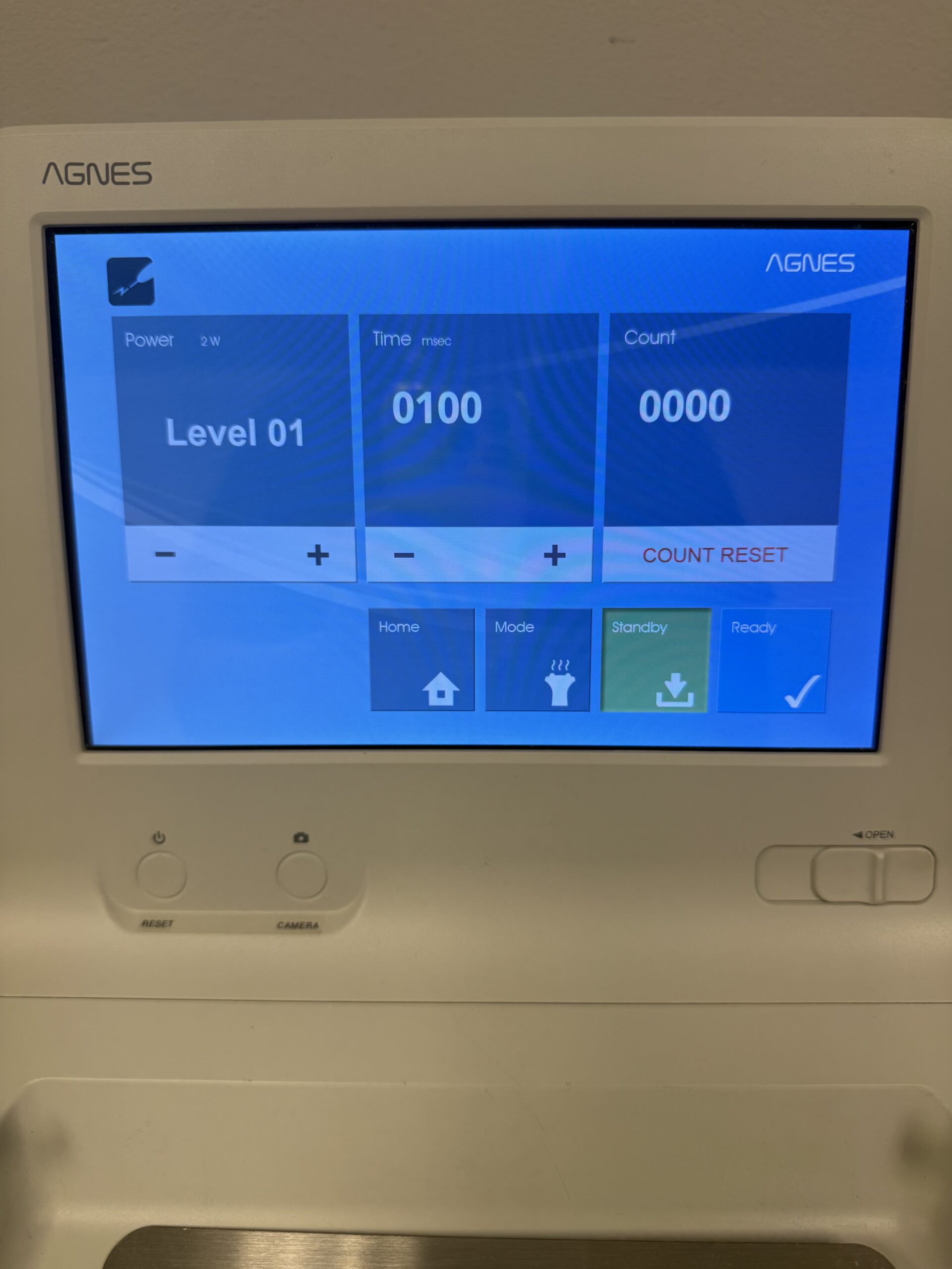 anges rf front screen view