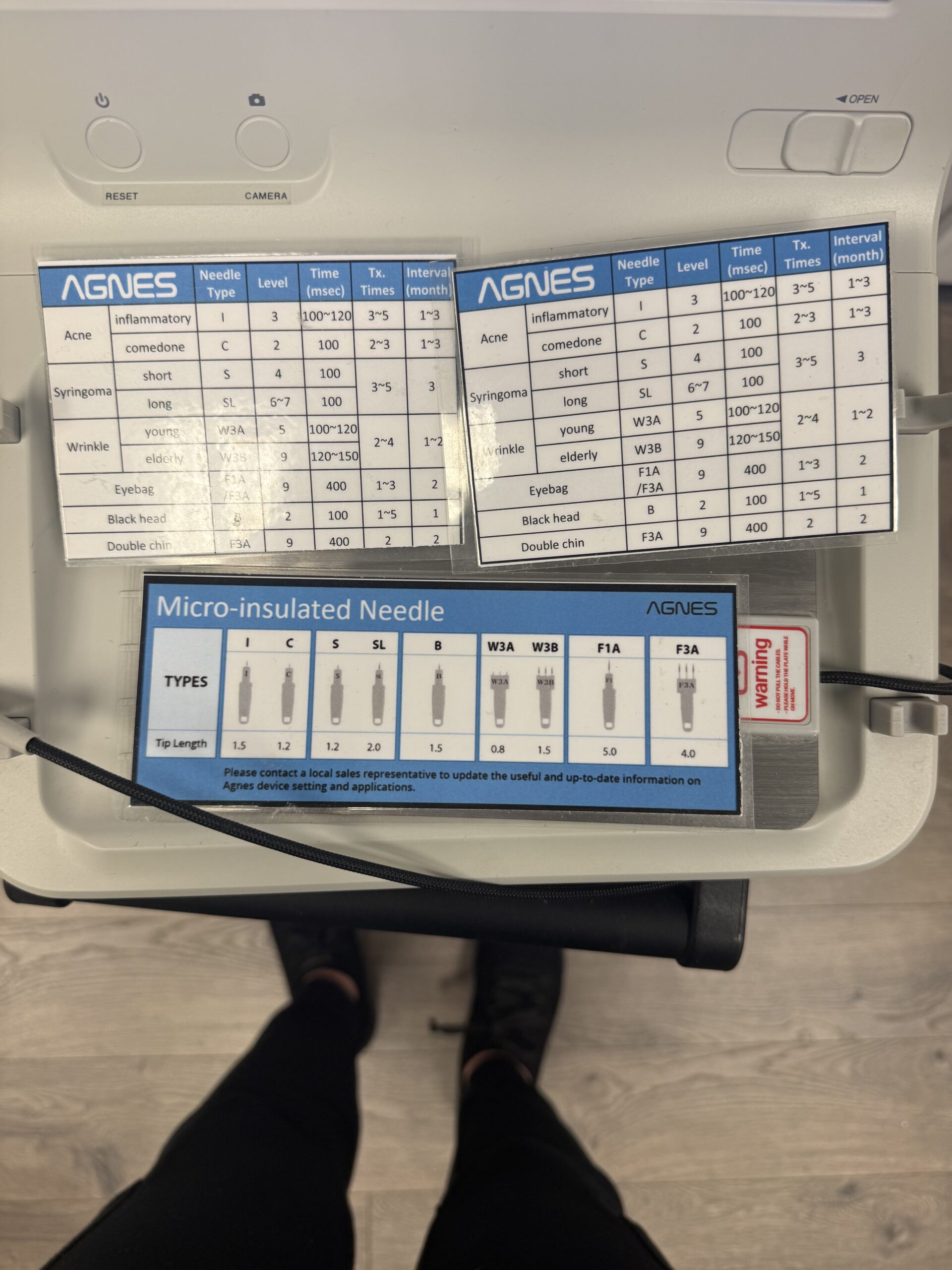 treatment parameters