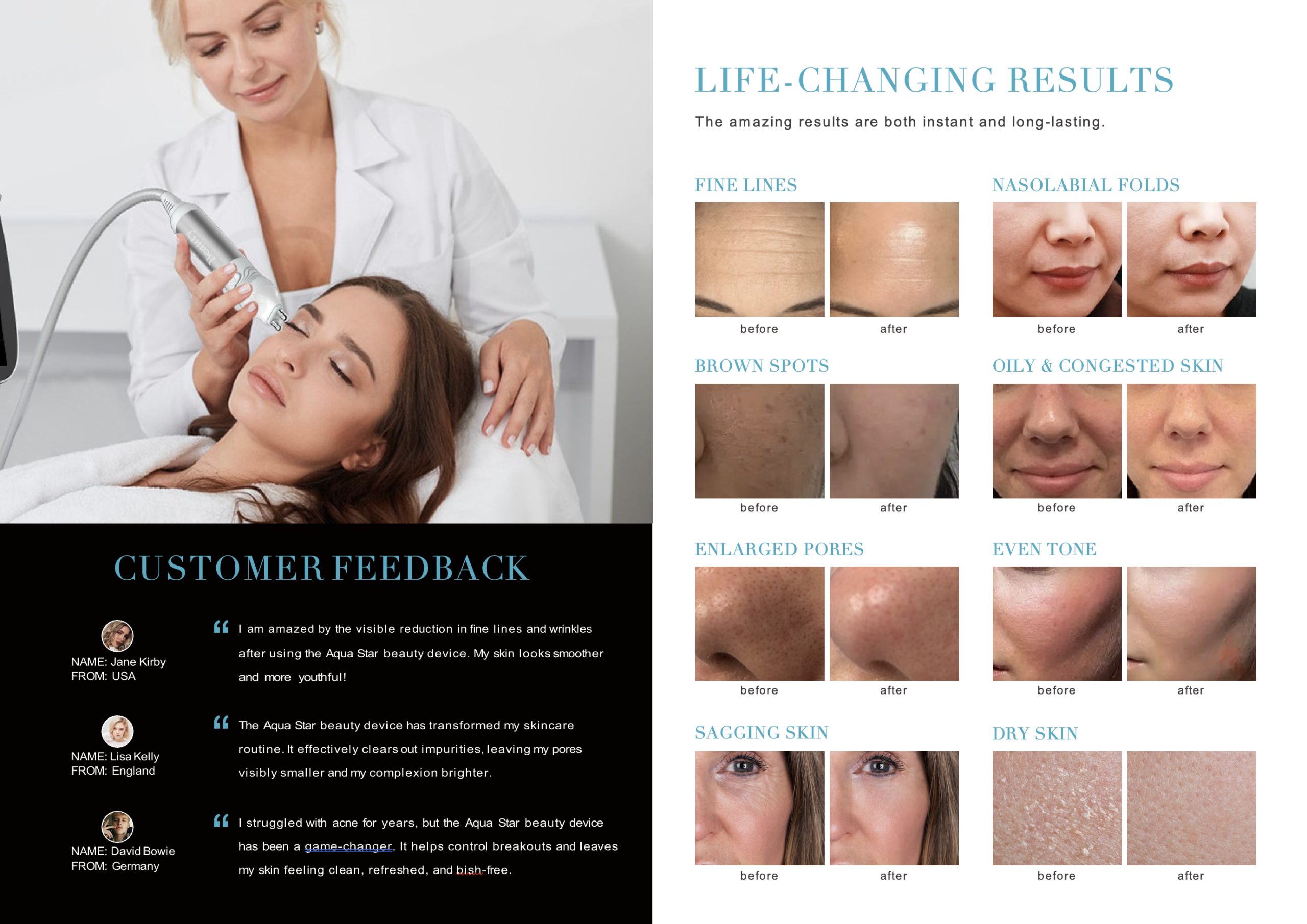 New 2026 Aesthetika AKUA Skin Facial System + Warranty - Image 37