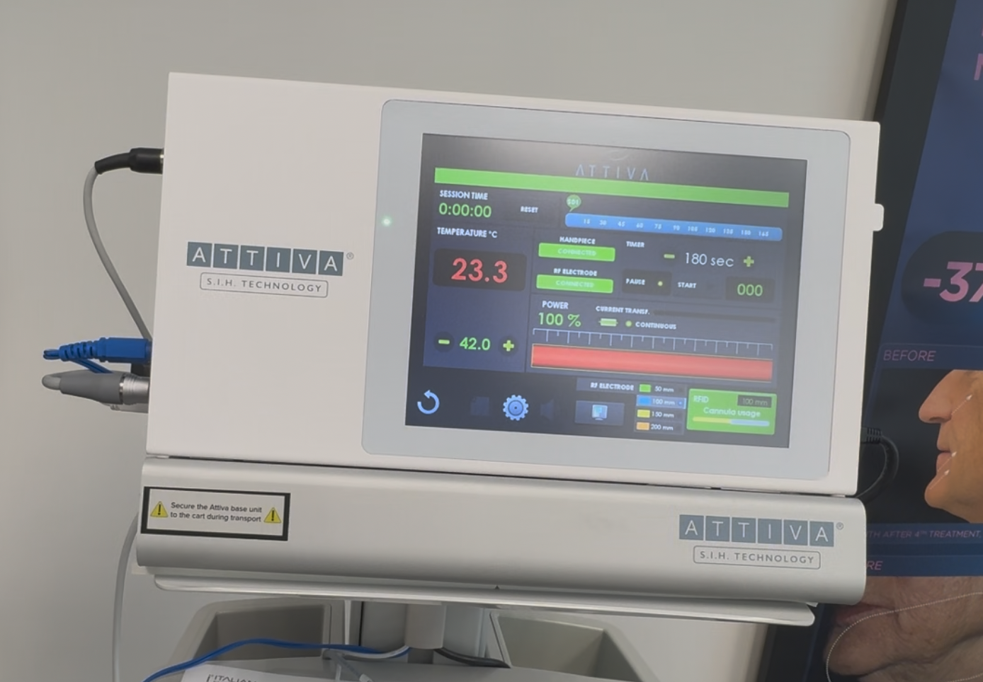 2024 Attiva RF For Sale - Under Skin RF + Warranty - Image 14